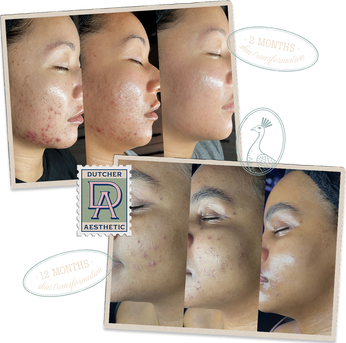 In-Person Treatments