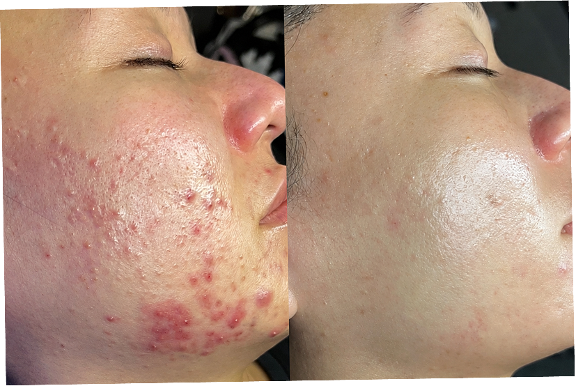This was a huge skin journey