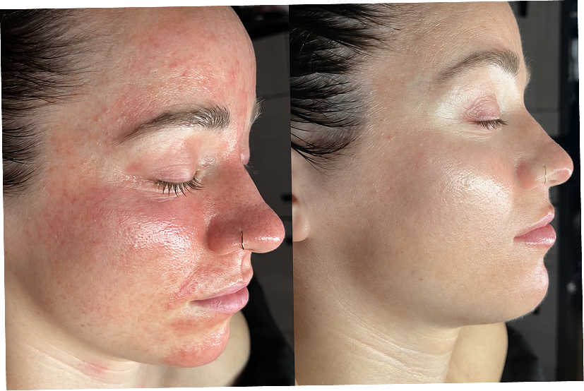 Truly healing the skin