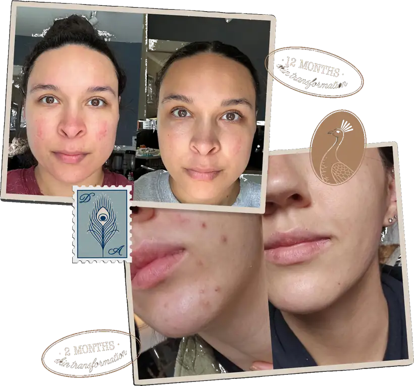 Virtual Skin Consultation